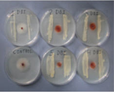 OXIDIAL on X: Ácido Peracético Esterilizante en frío, eficaz contra un  amplio espectro de bacterias, levaduras, hongos, esporas y biofilms.  Biodegradable, se descompone en Oxígeno y Dióxido de Carbono, por lo que