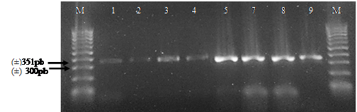 Producto PCR amplificado con los cebadores BLKC-delantero/ BLKC-reverso
del gen de la к-case&iacute;na en muestras de hembras bovinas identificadas por los n&uacute;meros
(1,2,3,4,5,7,8 y 9). Con la letra M se indica el marcador molecular de 100pb.