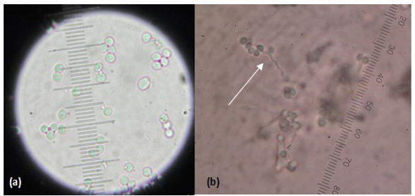 Conidias(a) y
conidi&oacute;foro en forma de raquis-100x (b)
de
B. bassiana-40x.