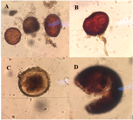 G&eacute;neros de HMA
identificados en muestras de suelo procedentes de  

fincas
con cultivos de c&iacute;trico, Glomus sp (A) Scutellospora sp (B) Acaulospora sp 

 (C) Septoglomus sp (D).