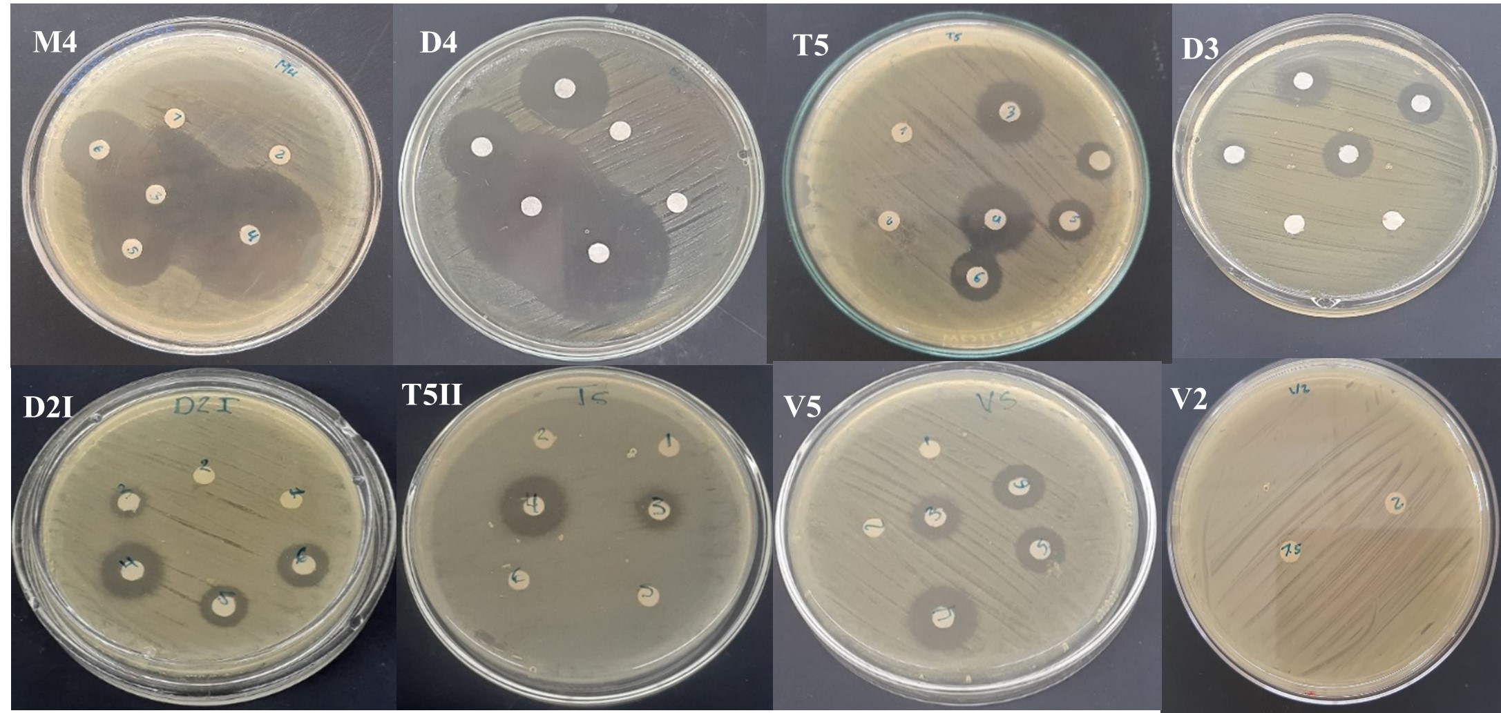 Aislados de Burkholderia gladiolii y
Burkholderia plantarii en medios de cultivo Mueller-Hinton. 