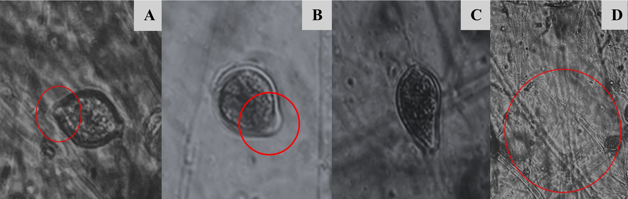 Estructuras reproductivas asexuales de Phytophthora infestans; A y B: esporangios semipapilados, C: esporangio limoniforme y D: Hifas no abultadas.