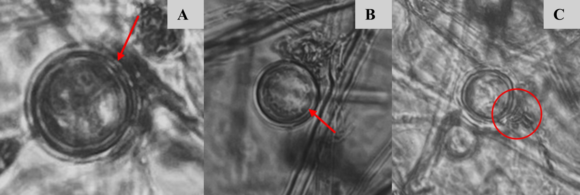 Estructuras reproductivas sexuales de Phytophthora infestans ; A y B: oogonios con oospora plerótica y C: oogonio con unión del anteridio anfígeno.